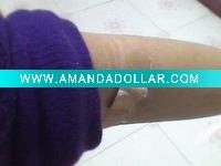 Wound Plaster First Aid